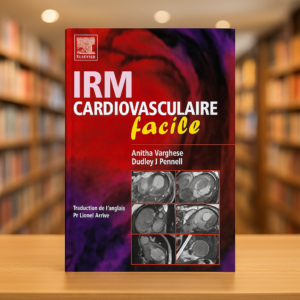 IRM Cardiovasculaire Facile – Anitha Varghese & Dudley J. Pennell