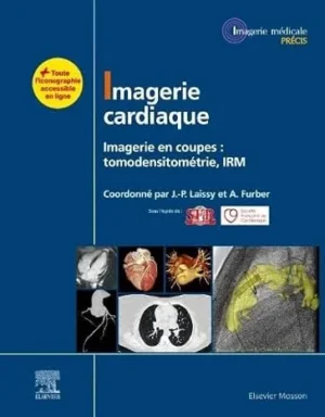 Imagerie cardiaque – Imagerie en coupes : tomodensitométrie, IRM